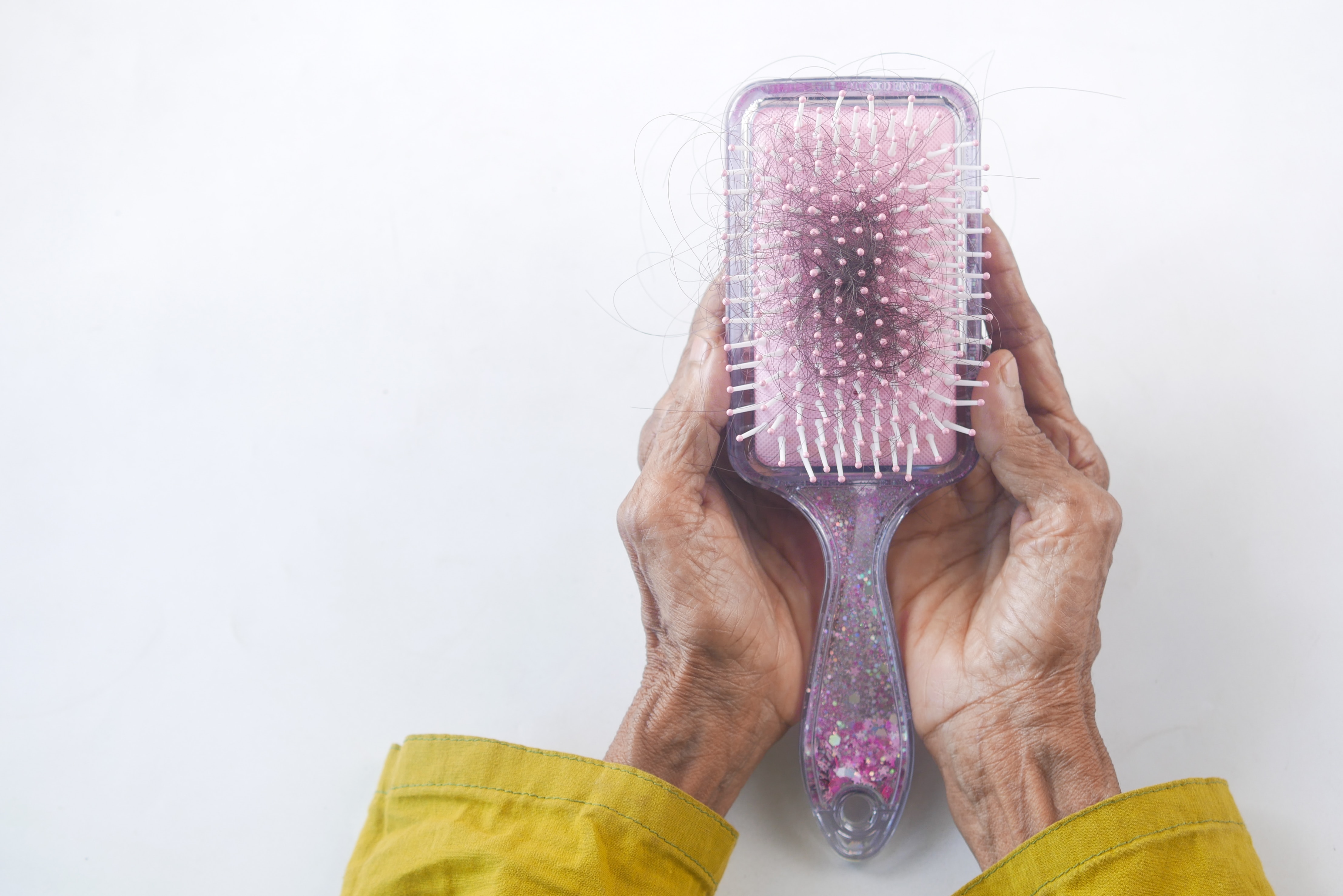 older person holding hair brush with clump of hair in it