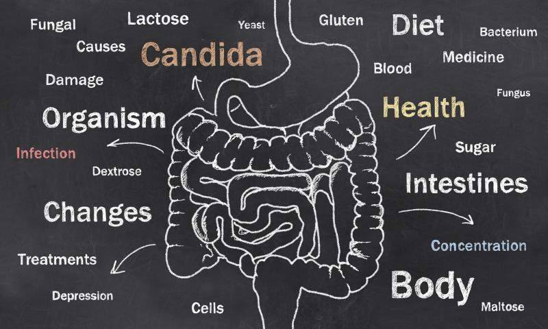 Treat a Candidiasis Infection Naturally: digestive system graphic with candida related terms