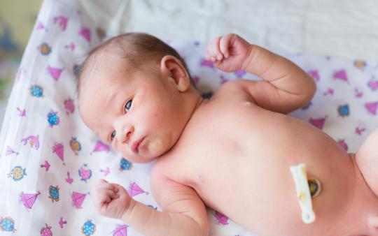 What To Do When The Umbilical Cord Falls Off: Newborn baby showing umbilical cord stump